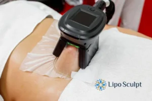Cryolipolysis Helping You Getting that Perfect Summer Body 3 Cryolipolysis Maidenhead can give you the best summer body - contact us today!