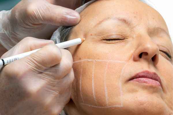 CryoPen: 5 Skin Concerns It May Be Used to Treat 4 What should you ask before having CryoPen treatment Maidenhead?