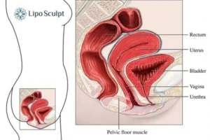 Treatment For A Leaky Bladder 2 How EM Chair treatment Maidenhead can help Leaky bladder issues. Read more now!