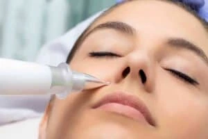 Best Actinic Keratoses Removal 3 Actinic keratoses Maidenhead solutions - book in today!