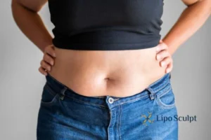 Bidding Farewell to Muffin Tops with Aqualyx Fat Injections 2 Do you wish you could reduce your muffin top Maidenhead With Aqualy fat dissolving injections you can!