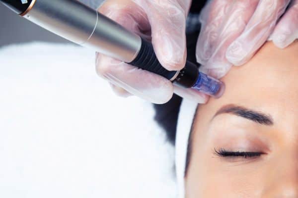 Explaining Total Skin Tightening Treatment and What to Expect 2 What Skin Concerns Can Total Skin Tightening Treatment Help With Maidenhead?